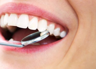 leistungen-crop Nahaufnahme eines geöffneten Mundes mit gesunden Zähnen und einem zahnärztlichen Spiegel bei der Kontrolle.